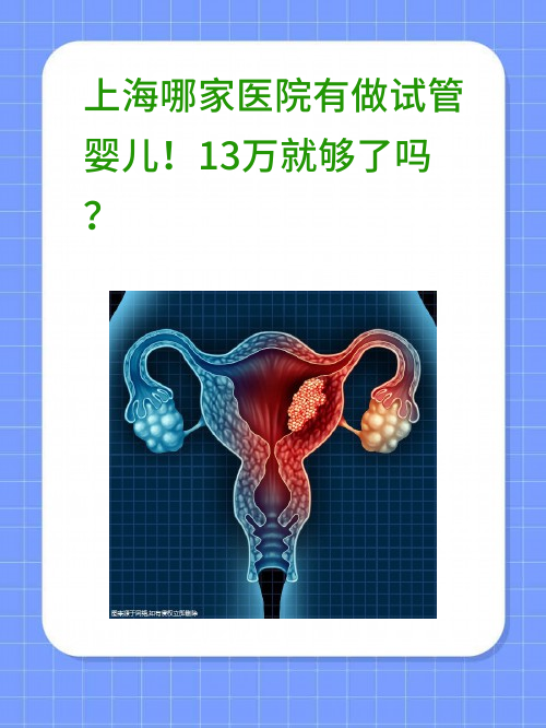 上海哪家医院有做试管婴儿！13万就够了吗？