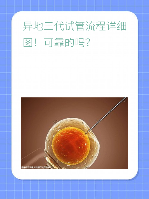 异地三代试管流程详细图！可靠的吗？