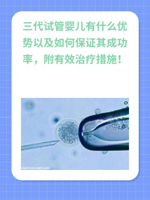 三代试管婴儿有什么优势以及如何保证其成功率，附有效治疗措施！