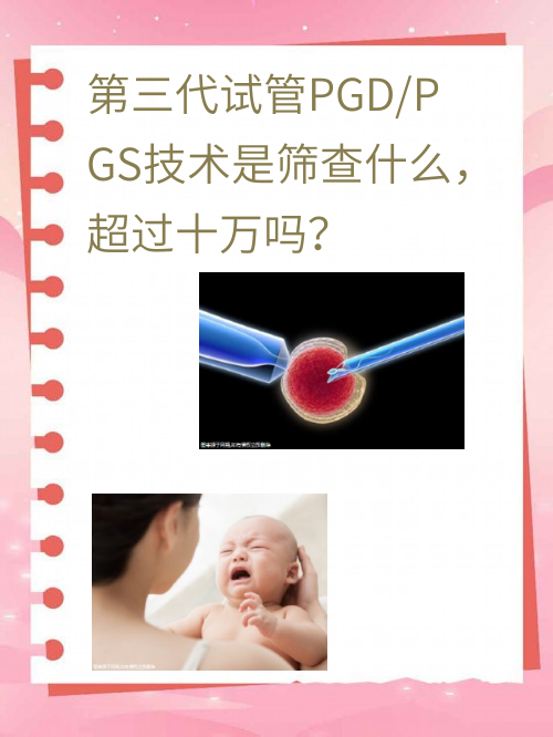 第三代试管PGD/PGS技术是筛查什么，超过十万吗？