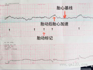 天门三代试管婴儿天门三代试管婴儿总共多少钱