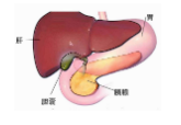 胆囊炎