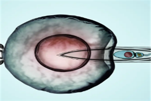 三代试管婴儿咨询