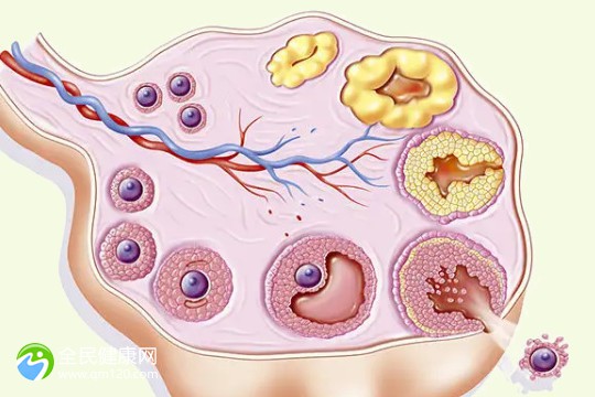 卵巢内液囊差能试管移植吗？