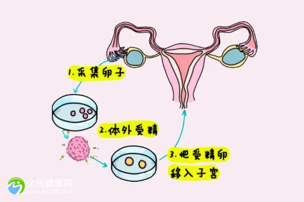 包头女性不孕不育症怎样治疗？