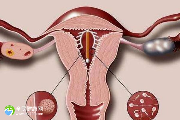 试管胎停的原因有哪些症状？