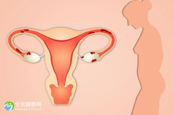 做完试管卵巢几个月恢复？