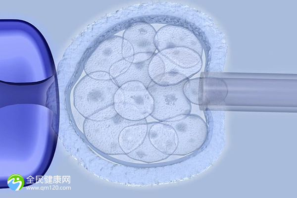 试管卵巢过度刺激怎么办？