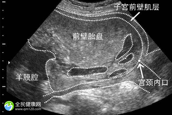 上饶私立医院做三代试管一般要多少钱