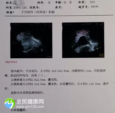 卵泡5个能做试管婴儿嘛？