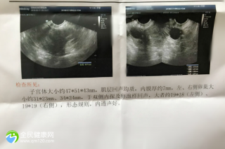 试管基础卵泡有5个正常吗？