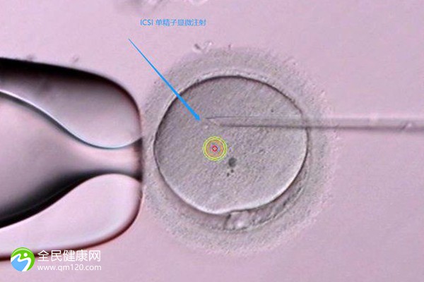 试管胚胎等级低为什么不着床？