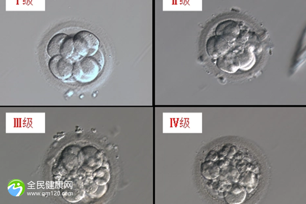 做三代试管婴儿有要求吗？