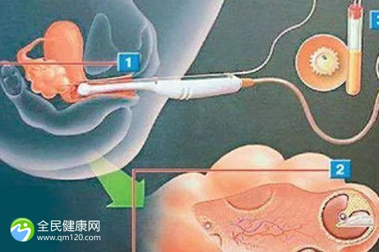 兰州第三代试管婴儿医院有几家？兰州试管医院排名