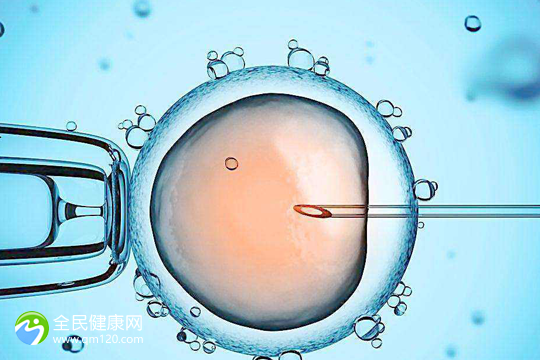 多囊性卵巢做试管婴儿吗？