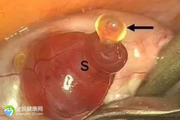 中山10大助孕机构有几家,建议收藏后查看