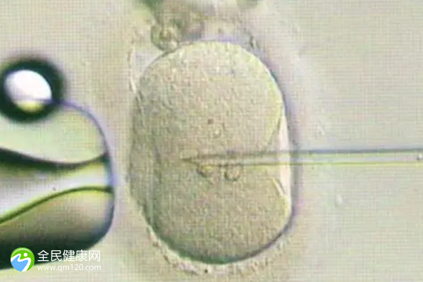 做三代试管囊胚怎么做流程？