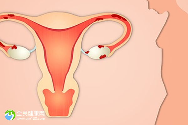 梅毒试管成功率有多高？想提高成功率教你一招