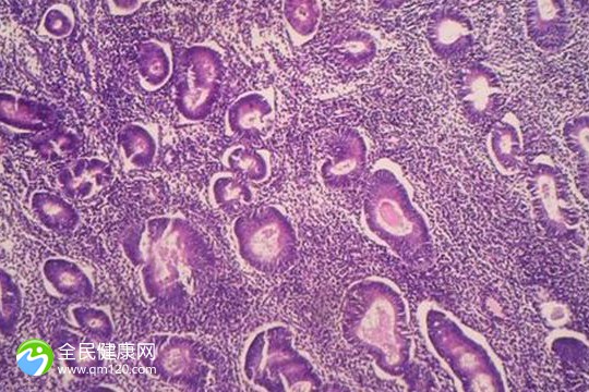 试管三代囊胚5cc成功率,三代试管5个囊胚筛选成功率