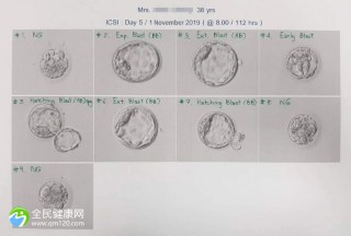 试管第一次失败第二次换医院吗？