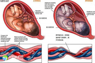 女性无精症可以做试管嘛？