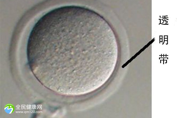 一代试管的精子经过挑选吗？