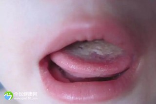 沈阳试管婴儿比较好医院：沈阳试管婴儿哪个医院好