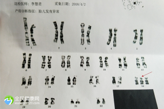 遵义试管能报销吗医保报销比例？