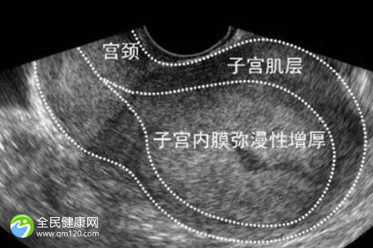 901医院做试管要求什么？