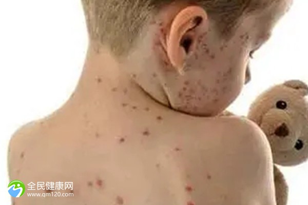 试管胎停要检查什么症状？