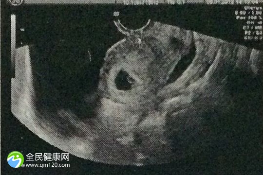 贵州哪些医院做试管婴儿 贵州哪些医院可以做试管婴儿