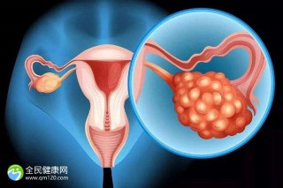 女性胆固醇高可以做试管婴儿吗？