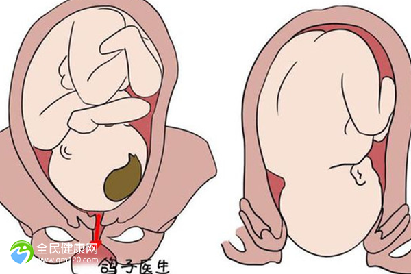 做试管婴儿后不想吃东西怎么办？