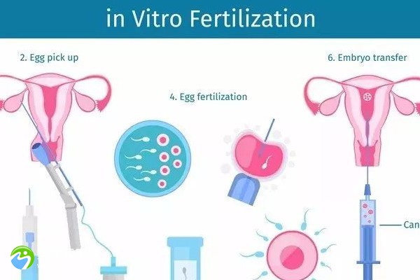 卵巢功能不好影响试管吗？