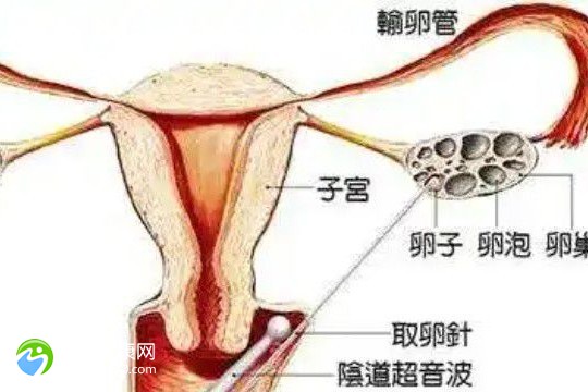 弱精症试管婴儿成功率是多少？