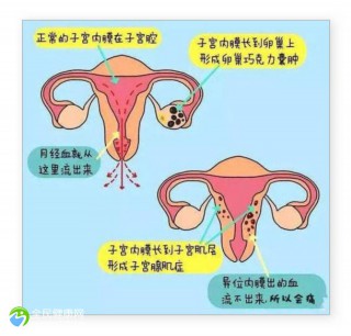 试管移植失败多久可以二次移植呢？