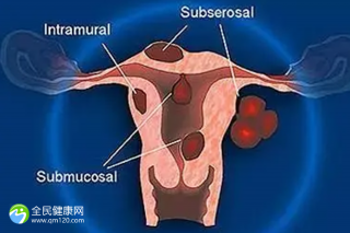 准备试管怎样保养卵巢？