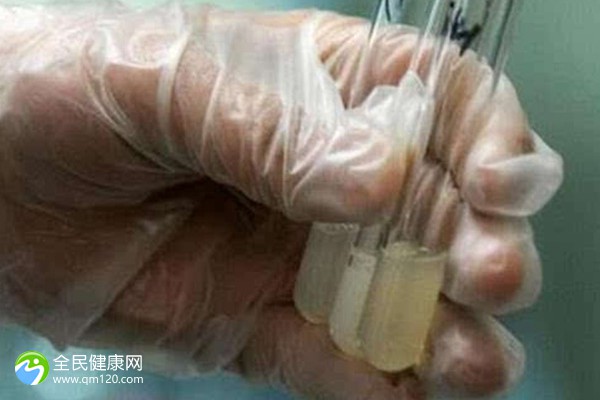 滁州男科医院哪家好一些？滁州同德男科专科医院怎么样？