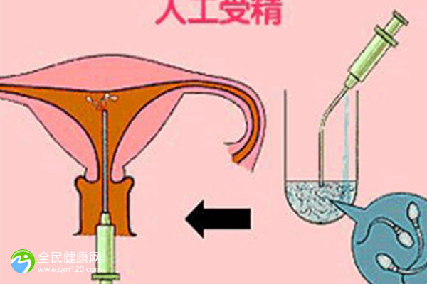 女性试管备孕可以吃山竹吗？