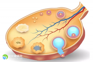 梅毒孕妇能不能顺产？