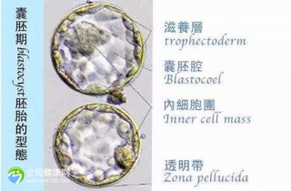 试管一次失败后第二次花多少钱？