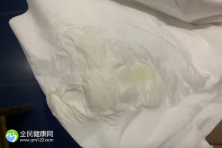 绍兴试管婴儿：绍兴试管婴儿费用明细是怎样的