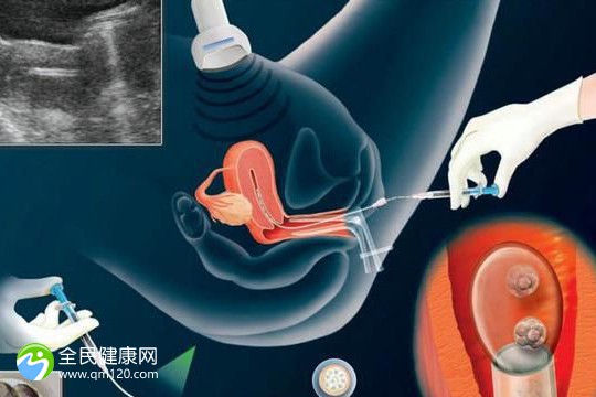 2023邯郸比较好的试管医院有哪家