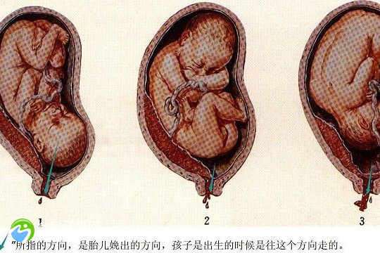 胚胎移植后尿多是什么原因？移植后尿多是不是胚胎着床了？