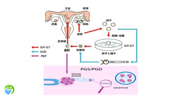 试管婴儿不成功是男的原因吗？