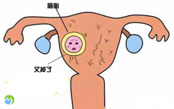 3次试管不成功还有必要继续吗？