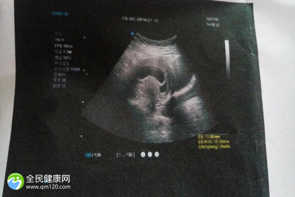 上海哪能做三代试管婴儿呢？
