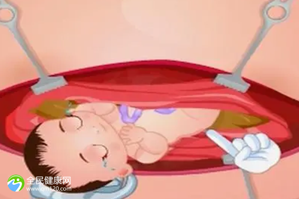 囊胚移植后如何正确食用杨梅？移植后如何合理食用杨梅？