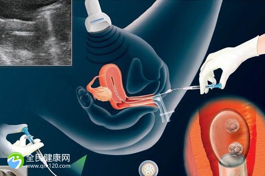 南京比较好的生殖科医院，试管婴儿比较权威的都在这