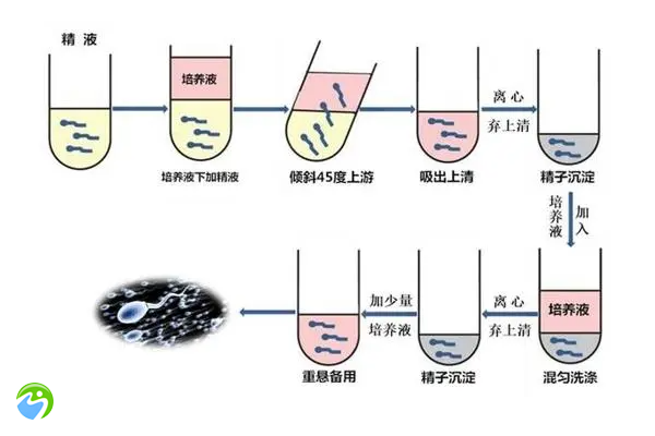 男的严重弱精子症可以做试管吗？成功率多少？